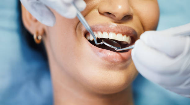 Best Emergency Dental Care for Abscessed Tooth in Golf Manor, OH